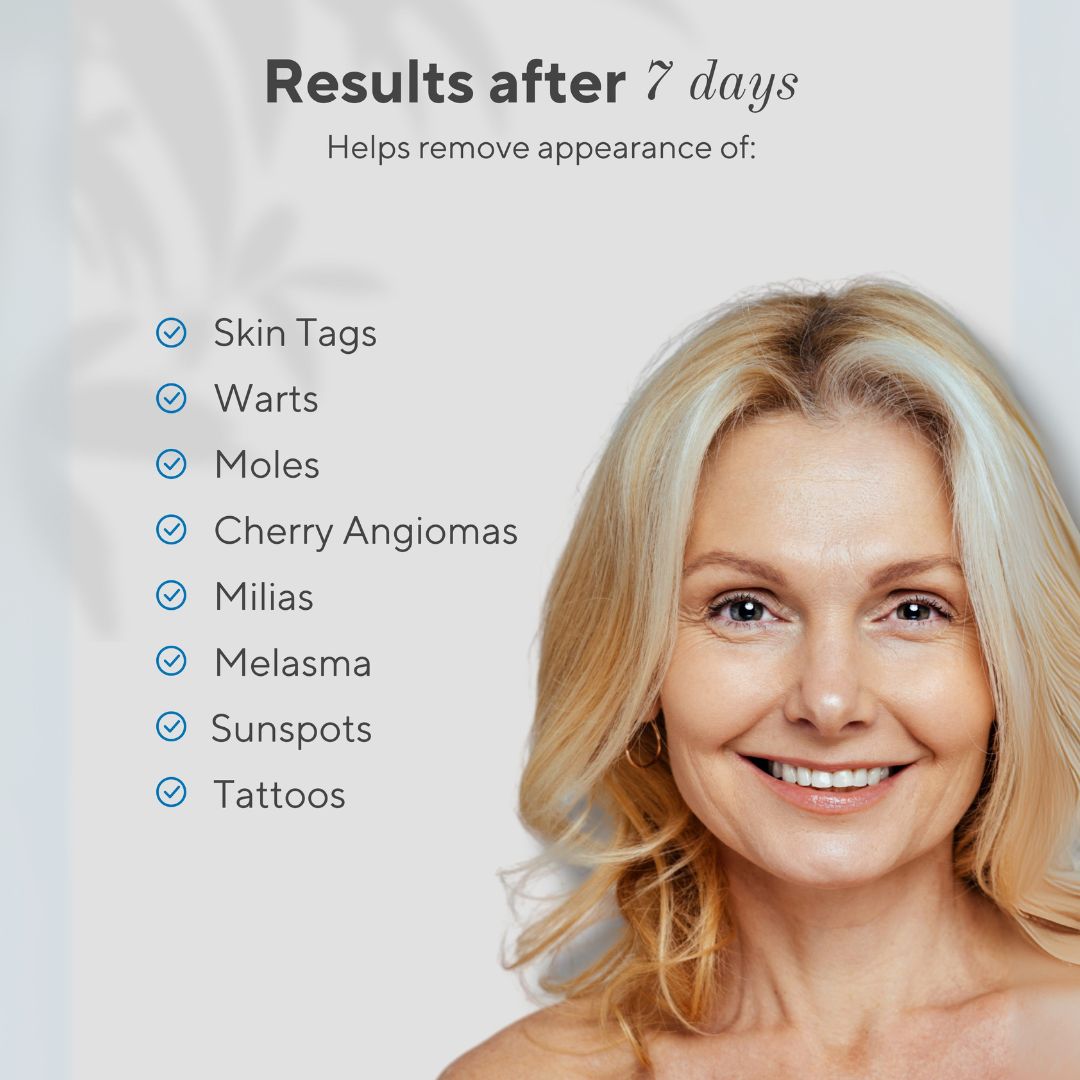 Clear Raised & Spot Blemishes at Home with ArcGuard™ Micro-Plasma Control