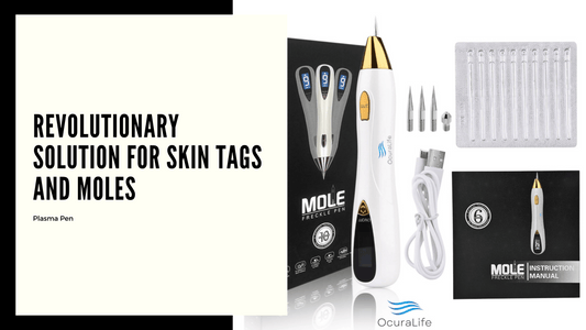 The Revolutionary Solution for Skin Tags and Moles - Plasma Pen