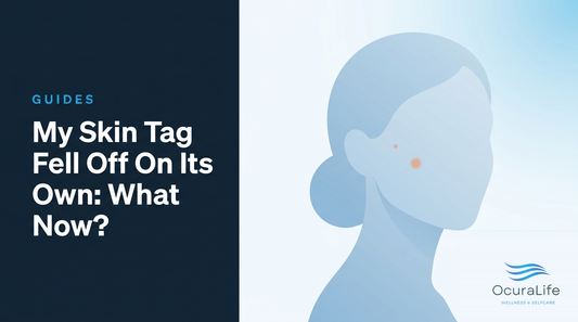 My Skin Tag Fell Off On Its Own: What Now?