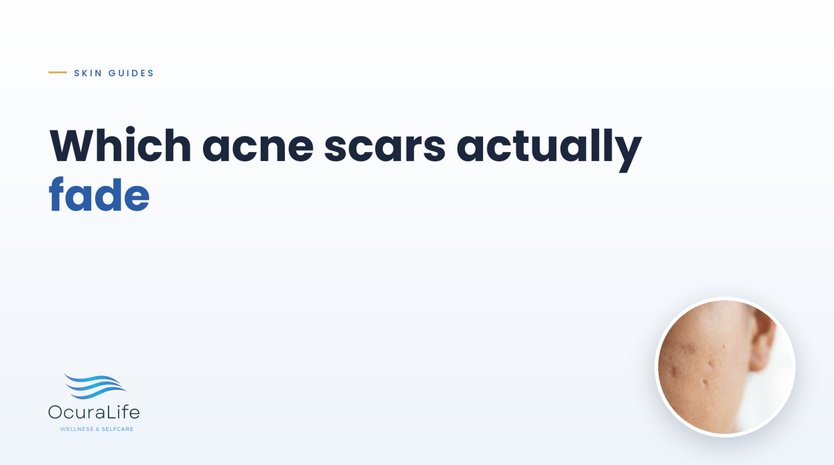 Which acne scars actually fade: flat marks versus indented scars