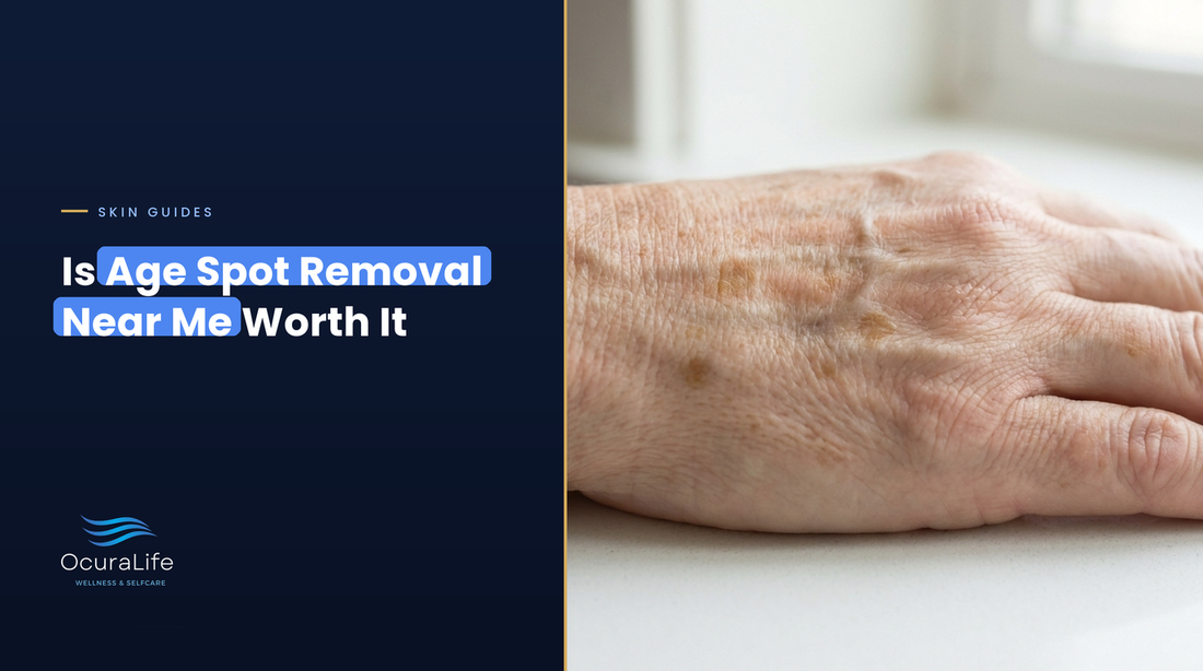 Back of a hand with flat tan age spots, cover for Is age spot removal near me worth it
