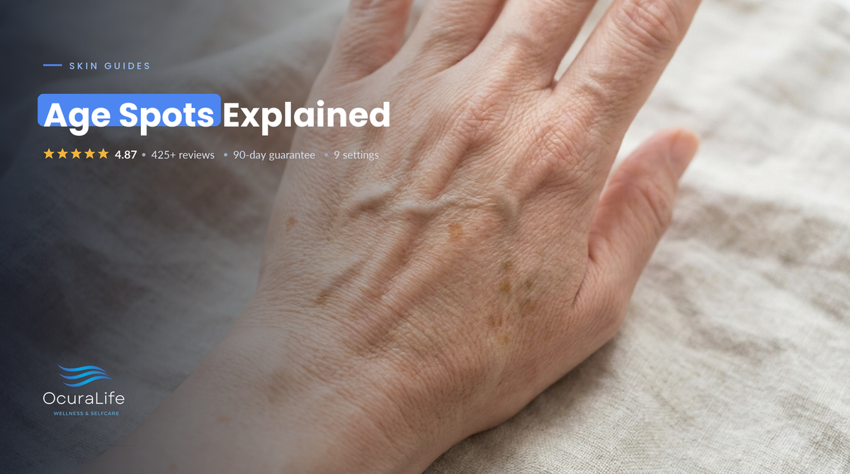 Flat tan age spots on the back of a woman's hand
