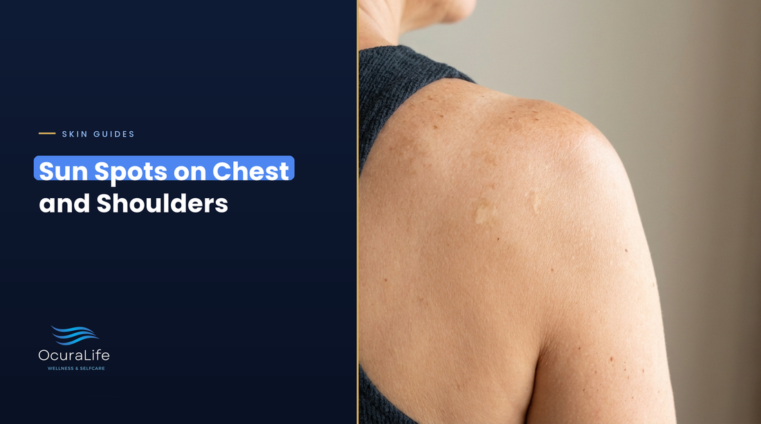 Flat light brown sun spots and freckles on a woman's bare shoulder