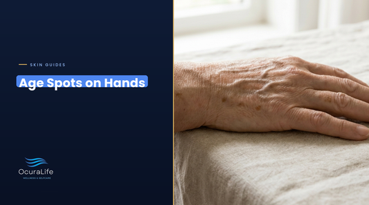 Flat tan age spots on the back of a woman's hand in her 60s