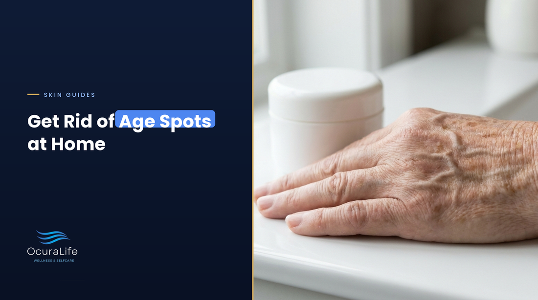 Back of an older hand with flat brown age spots, a guide to getting rid of age spots at home