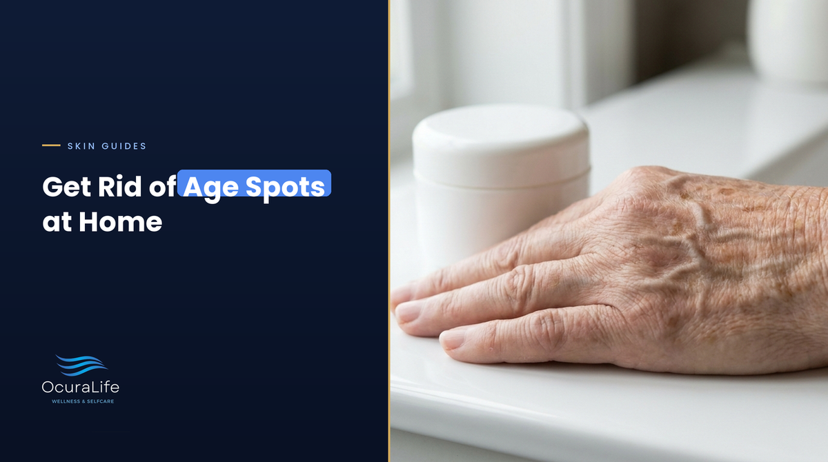 Back of an older hand with flat brown age spots, a guide to getting rid of age spots at home