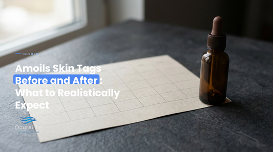 Amoils Skin Tags Before and After: What to Realistically Expect
