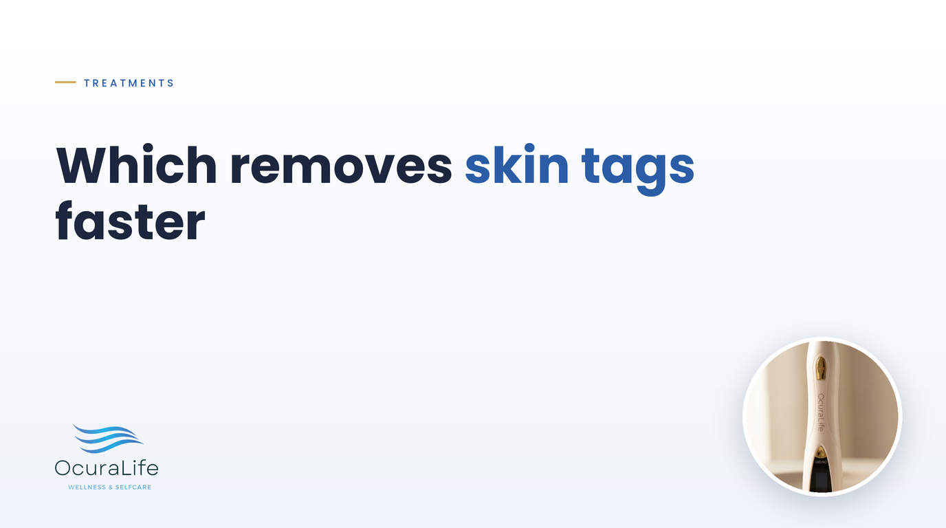 Amoils vs Ocura for Skin Tags: Which Removes Them Faster?