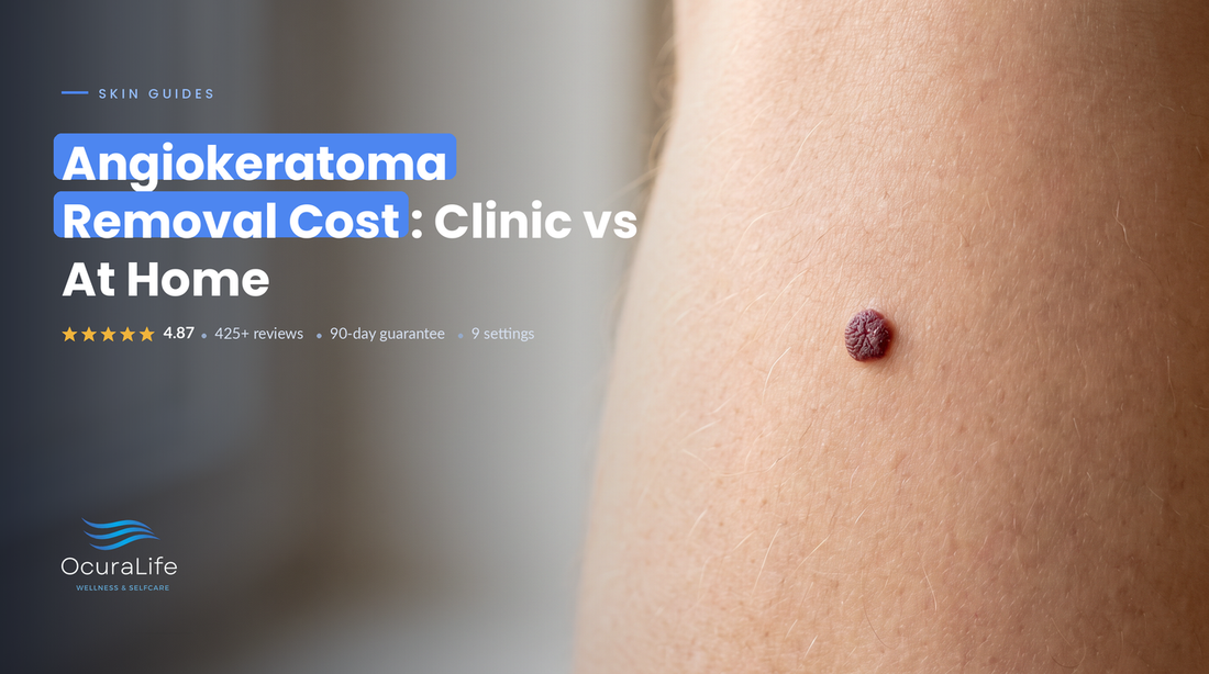 Angiokeratoma Removal Cost: Clinic vs At Home