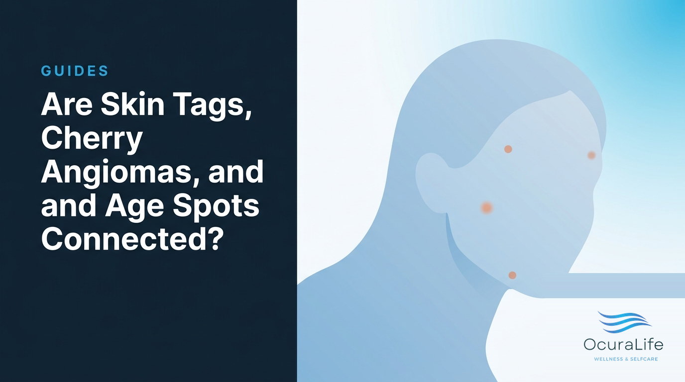 Are Skin Tags, Cherry Angiomas, and Age Spots Connected?