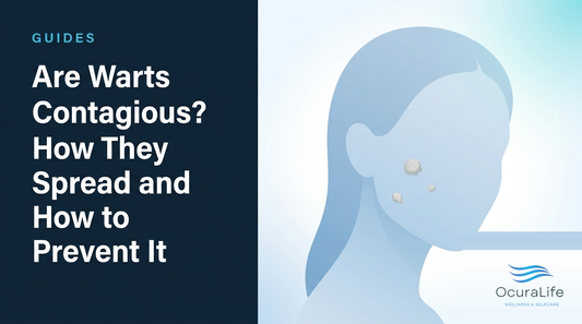 Are Warts Contagious? How They Spread and How to Prevent It - OcuraLife