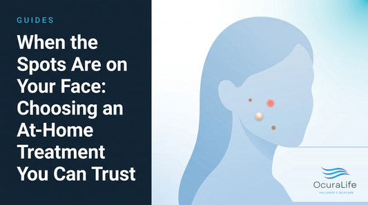 Editorial illustration: When the Spots Are on Your Face: Choosing an At-Home Treatment You Can Trust
