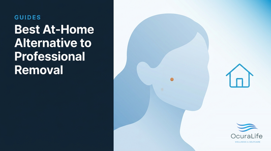 Best At-Home Alternative to Professional Removal