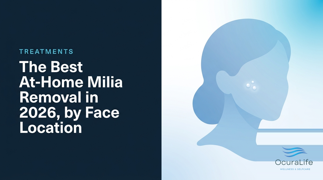 The Best At-Home Milia Removal in 2026, by Face Location - OcuraLife