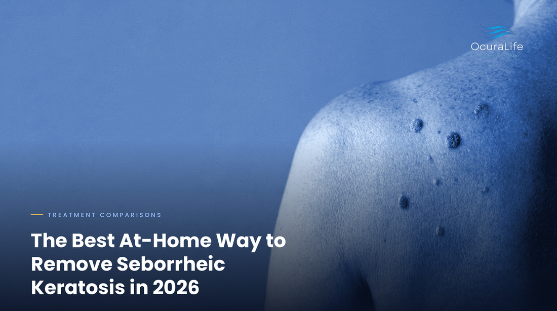 The Best At-Home Way to Remove Seborrheic Keratosis in 2026