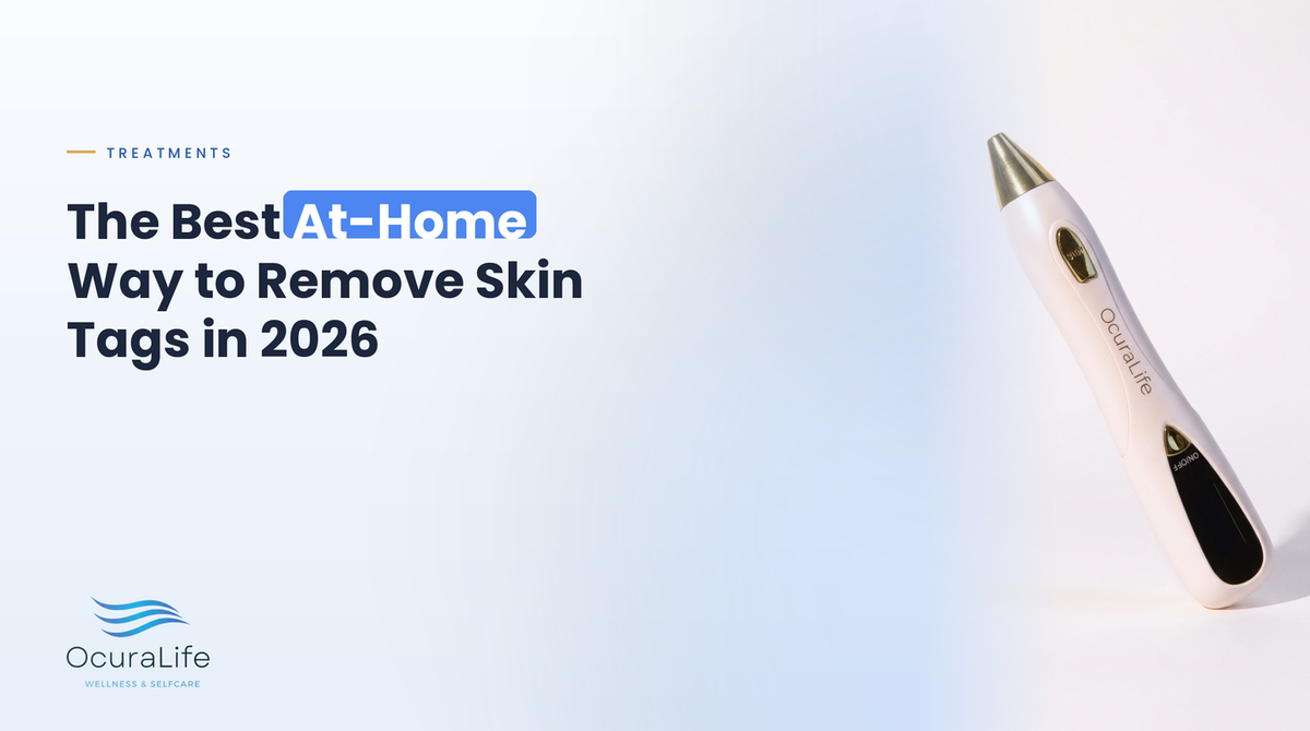 The Best At-Home Way to Remove Skin Tags in 2026