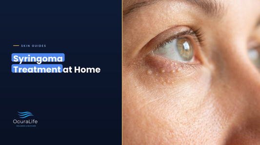Syringoma treatment at home: small skin-colored syringoma bumps under the eye