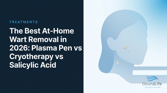 The Best At-Home Wart Removal in 2026: Plasma Pen vs Cryotherapy vs Salicylic Acid - OcuraLife