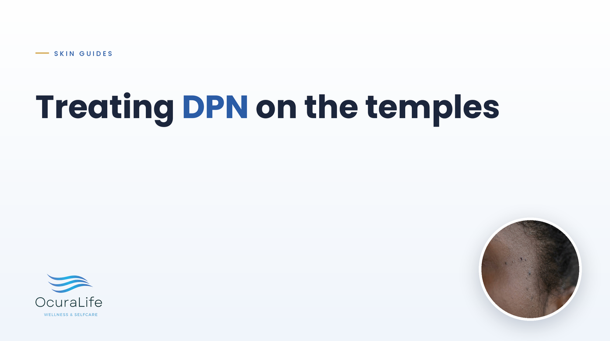 The Best At-Home Way to Treat DPN on the Temples