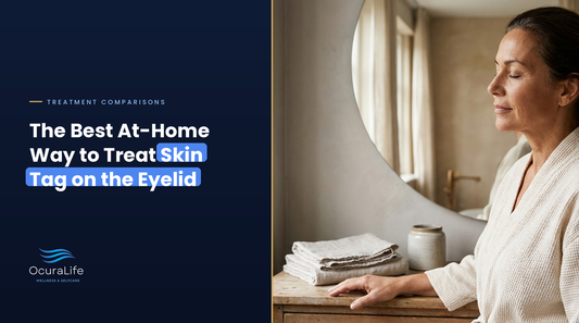 The Best At-Home Way to Treat Skin Tag on the Eyelid
