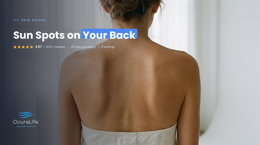 The Best At-Home Way to Treat Sun Spot on the Back