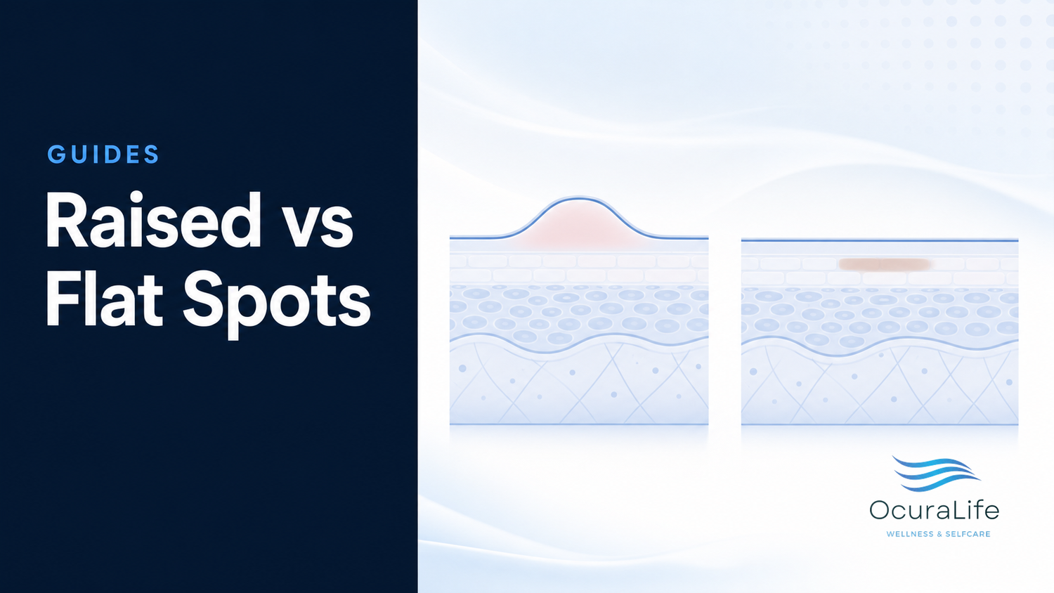 Illustration comparing raised and flat skin spots for the OcuraLife guide