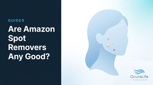 Are Amazon Spot Removers Any Good?