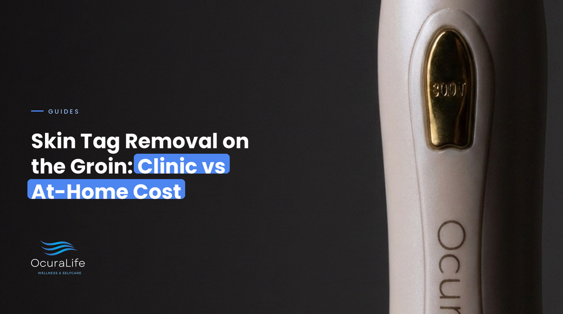 Skin Tag Removal on the Groin: Clinic vs At-Home Cost