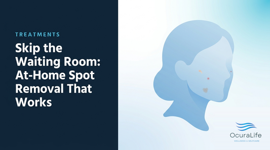 Skip the Waiting Room: At-Home Spot Removal That Works
