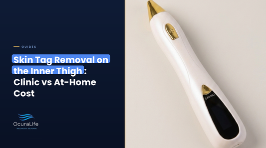 Skin Tag Removal on the Inner Thigh: Clinic vs At-Home Cost