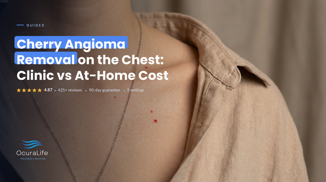 Cherry Angioma Removal on the Chest: Clinic vs At-Home Cost