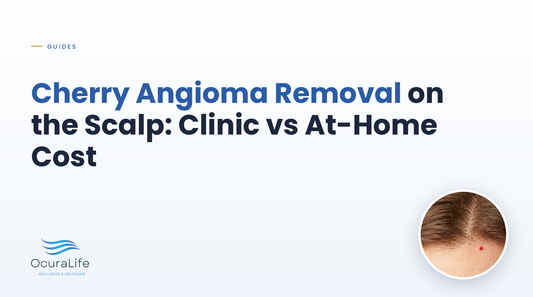 Cherry Angioma Removal on the Scalp: Clinic vs At-Home Cost