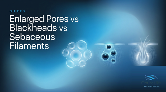 Enlarged Pores vs Blackheads vs Sebaceous Filaments