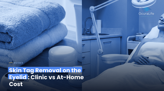 Skin Tag Removal on the Eyelid: Clinic vs At-Home Cost