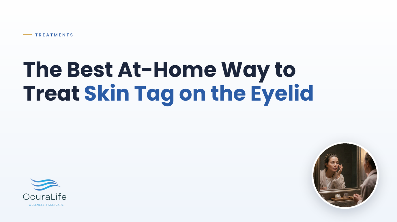 The Best At-Home Way to Treat Skin Tag on the Eyelid