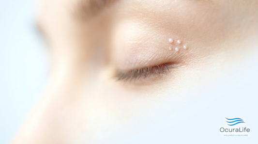Milium Cyst on the Eyelid: How to Identify It