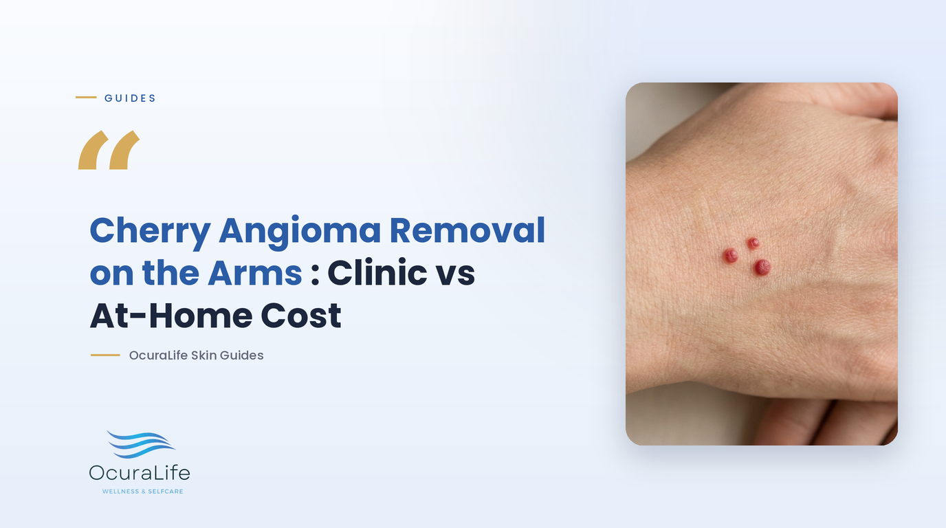 Cherry Angioma Removal on the Arms: Clinic vs At-Home Cost