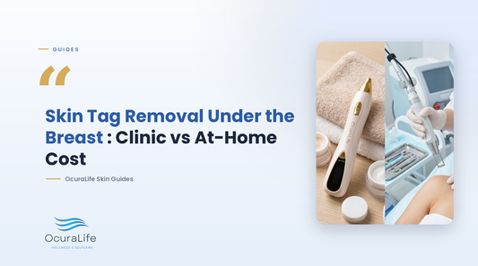 Skin Tag Removal on the Under The Breast: Clinic vs At-Home Cost