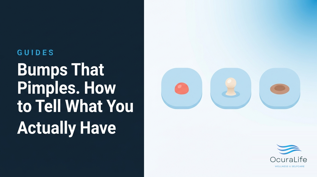 Bumps That Aren't Pimples. How to Tell What You Actually Have - OcuraLife