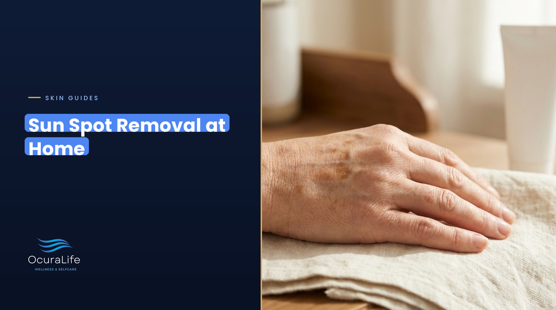 Back of a mature hand with flat tan-brown sun spots, cover for sun spot removal at home