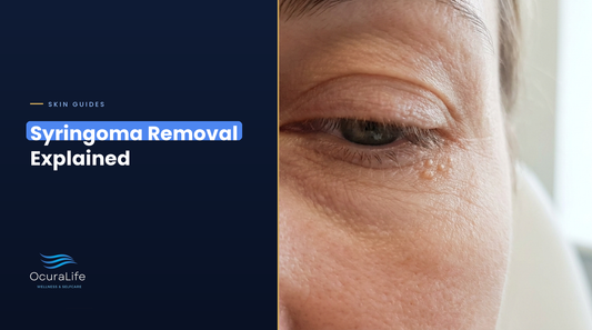 Small cluster of syringoma bumps under the eye, syringoma removal explained