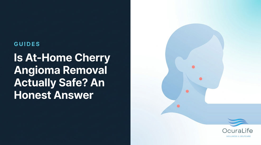 Is At-Home Cherry Angioma Removal Actually Safe? An Honest Answer - OcuraLife