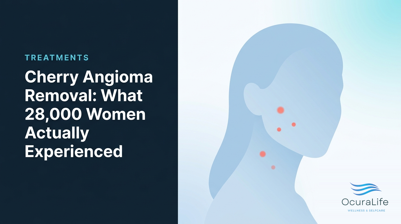 Cherry Angioma Removal: What 28,000 Women Actually Experienced - OcuraLife