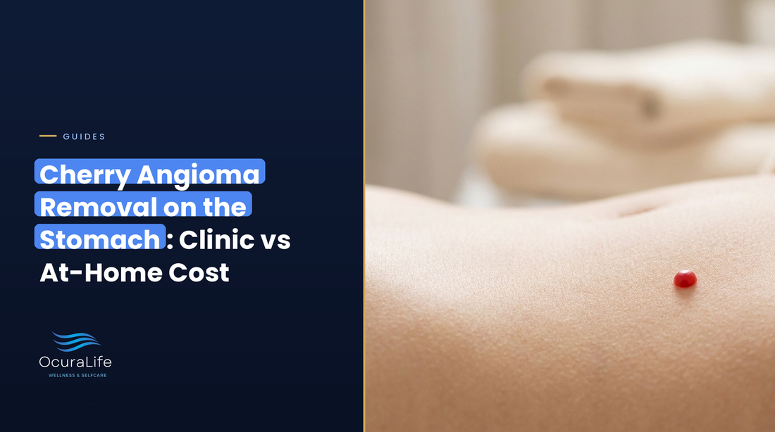 Cherry Angioma Removal on the Stomach: Clinic vs At-Home Cost