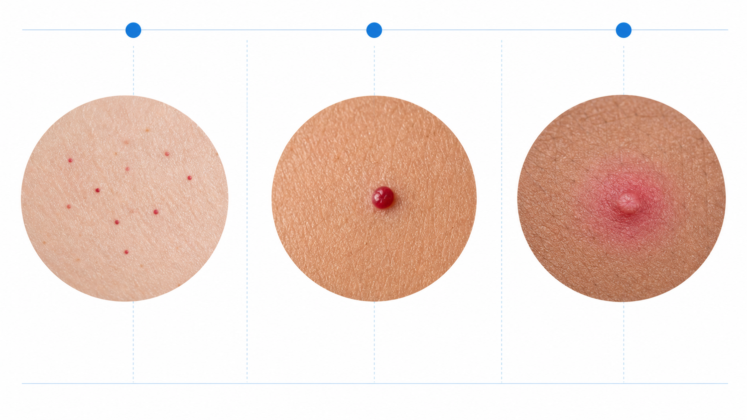 Red Spot Comparison Chart: Angioma, Petechiae, Bug Bite infographic