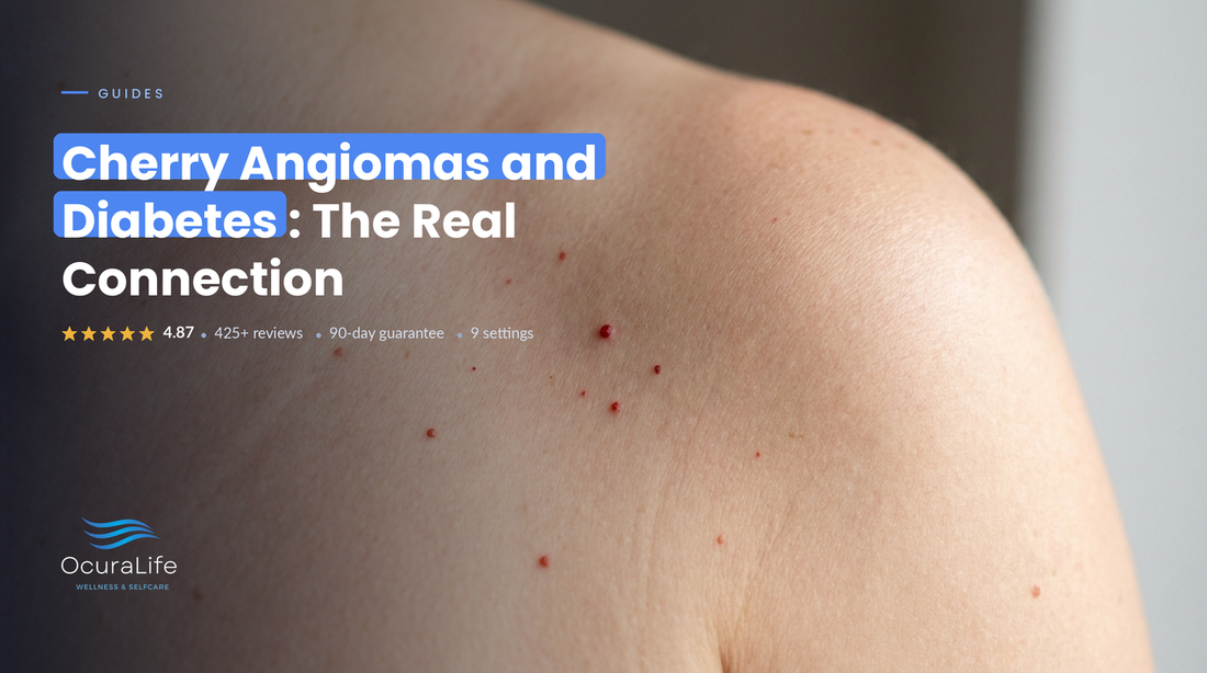 Cherry Angiomas and Diabetes: The Real Connection