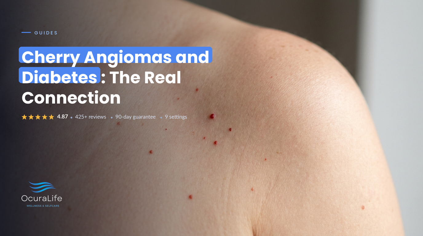 Cherry Angiomas and Diabetes: The Real Connection