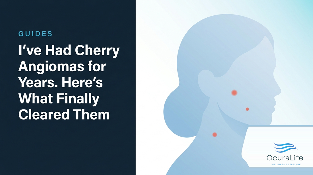 I've Had Cherry Angiomas for Years. Here's What Finally Cleared Them - OcuraLife
