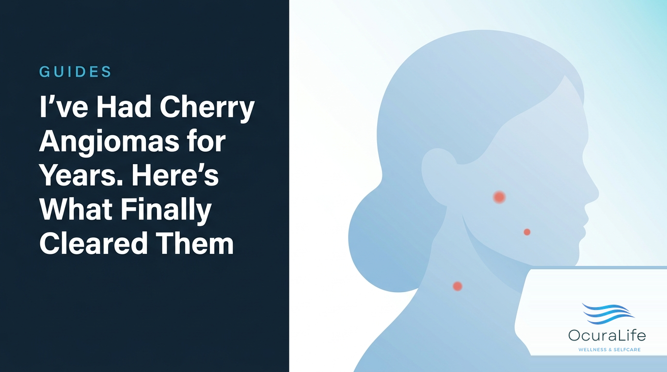 I've Had Cherry Angiomas for Years. Here's What Finally Cleared Them - OcuraLife
