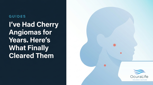 I've Had Cherry Angiomas for Years. Here's What Finally Cleared Them - OcuraLife